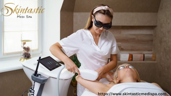 Laser Hair Removal in Riverside