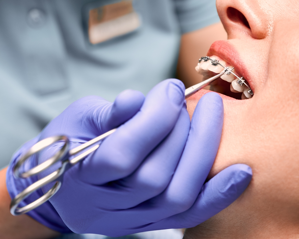orhtodontic-dentistry-in-dubai